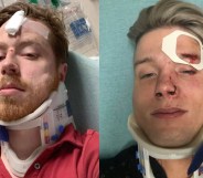 Texas gay couple Spencer Deehring and Tristan Perry were both hospitalised after the brutal anti-gay attack.