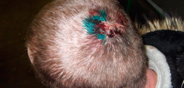 The injury sustained by a Russian man who claimed police beat him up because he's gay.