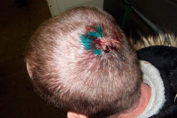 The injury sustained by a Russian man who claimed police beat him up because he's gay.