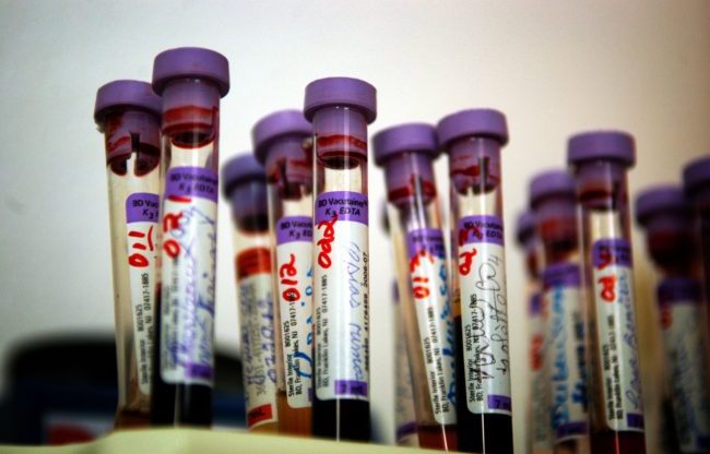 Blood test tubes