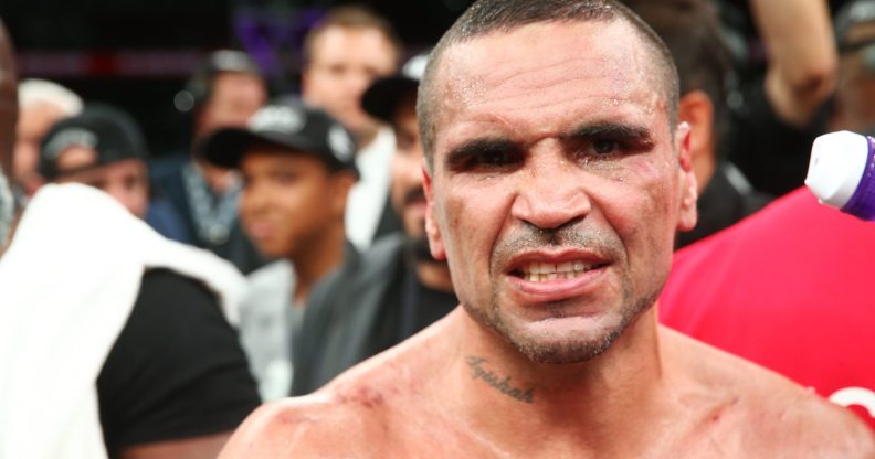 ADELAIDE, AUSTRALIA - FEBRUARY 03: Australian boxer Anthony Mundine looks on after his cruiserweight bout with Danny Green at Adelaide Oval on February 3, 2017 in Adelaide, Australia. (Photo by Morne de Klerk/Getty Images)