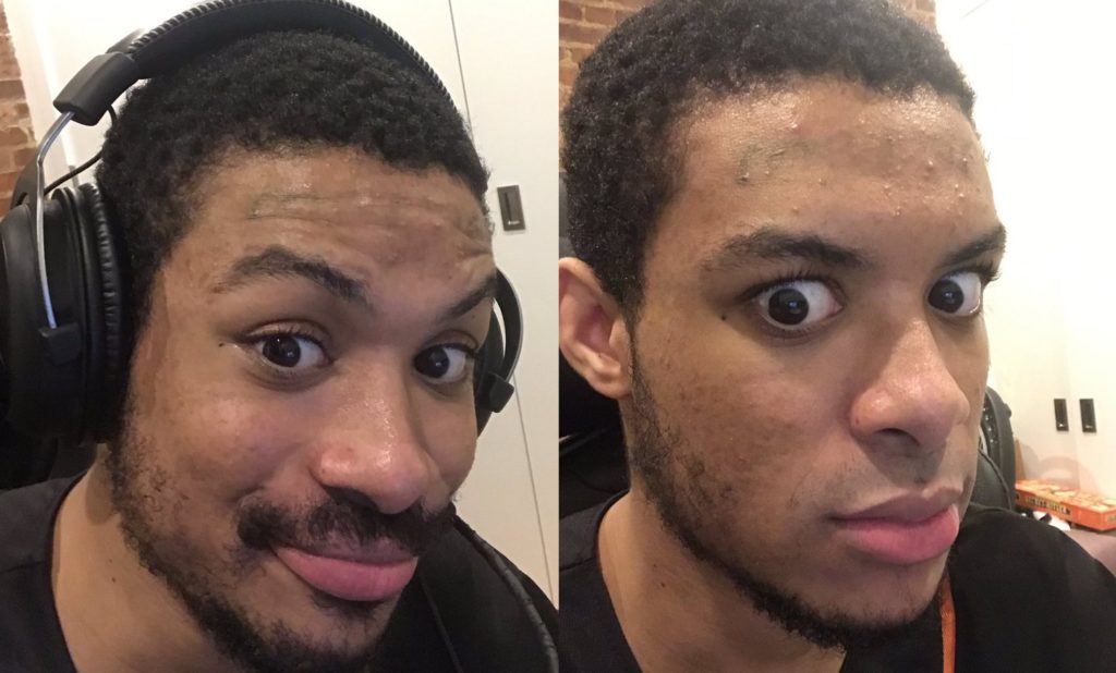 SonicFox shaved his moustache after raising $20,000 for charity