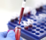 A scientists holding a test tube full of blood