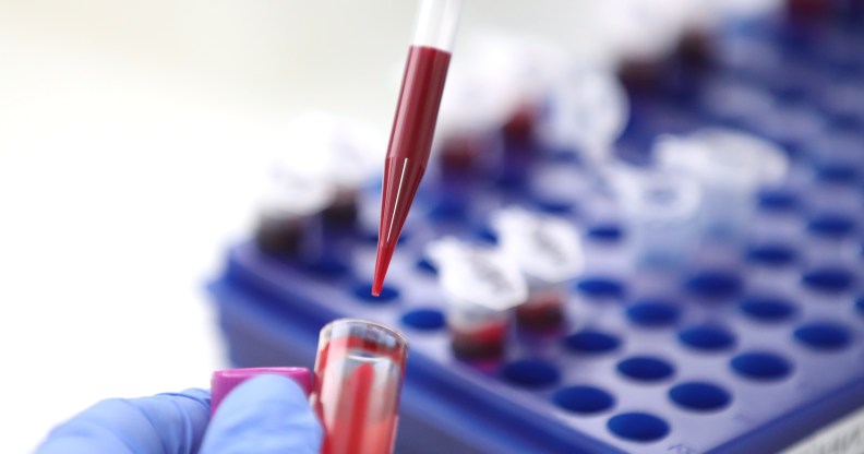 A scientists holding a test tube full of blood