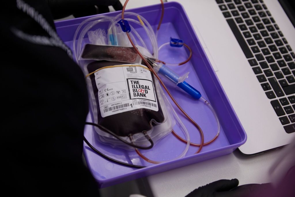 A pint of donated blood from the bank. (UNILAD)