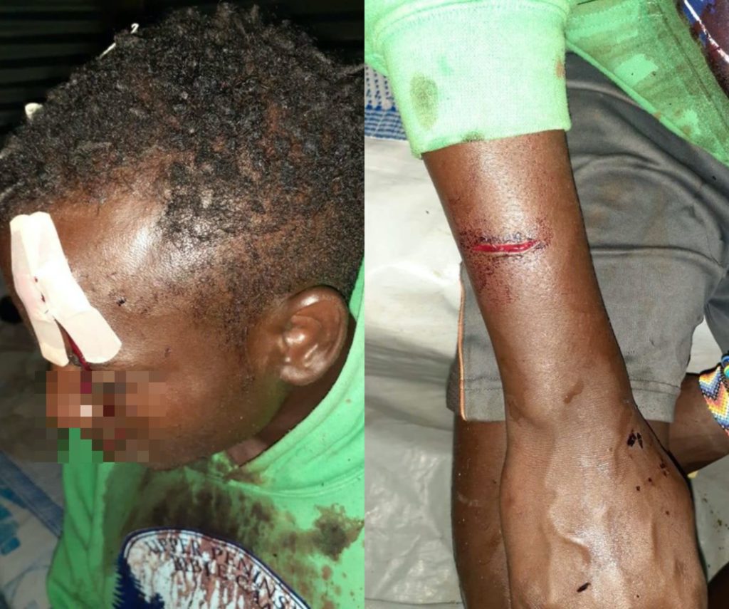 Stephen Sebuuma suffered cuts to their head and arm as a result of the attack. (Facebook)