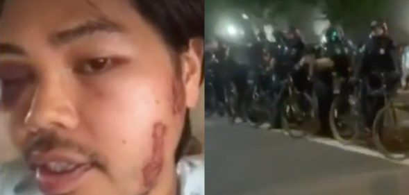 Tee Fansofa was shot, they claimed, twice with rubber bullets and once with a tear gas canister by Sacramento Police Department officers. (Screen captures via CBS)