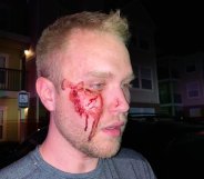 Christian Council: Thugs beat gay man unconscious while screaming slurs