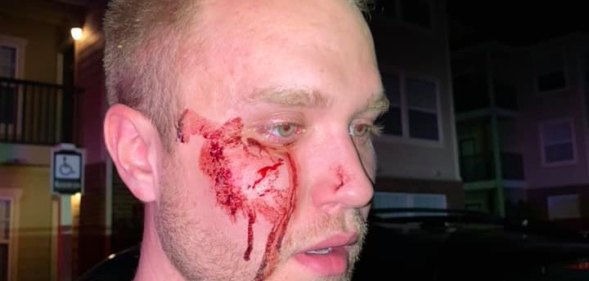 Christian Council: Thugs beat gay man unconscious while screaming slurs