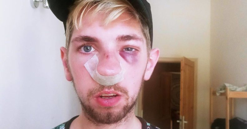 Poland: Gay man beaten up with 'telescopic baton' in broad daylight