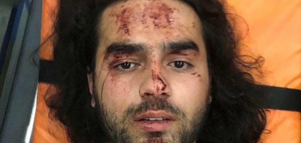 Armenia gay LGBT assault