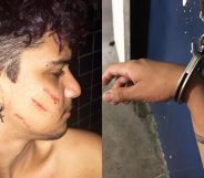 Lorran Oliveira, a 21-year-old photographer, was beaten with a broomstick by a neighbour. (Facebook)