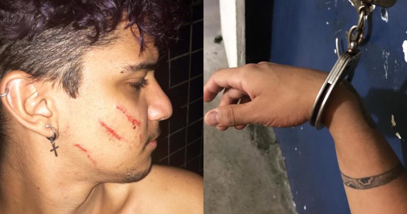 Lorran Oliveira, a 21-year-old photographer, was beaten with a broomstick by a neighbour. (Facebook)