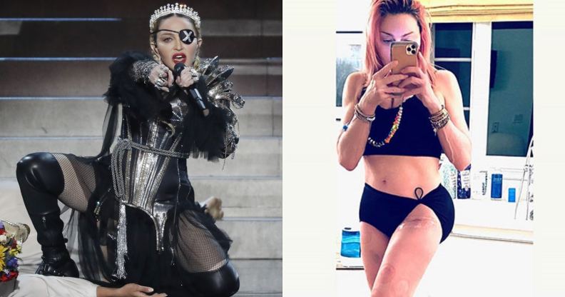 Madonna has showed off her "beautiful" hip scar from the injury that curtailed her Madame X tour