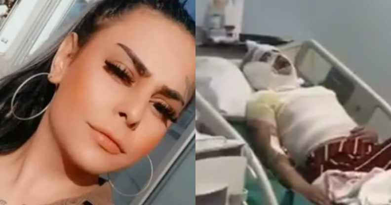 On the left: Asya Cevahir poses to the camera. On the right: Asya Cevahir lies in a hospital bed covered in bandages