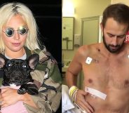 On the left: Lady Gaga in a camouflage jacket holding a French bulldog. On the right: Ryan Fischer, shirtless, sits upright on a hospital bed