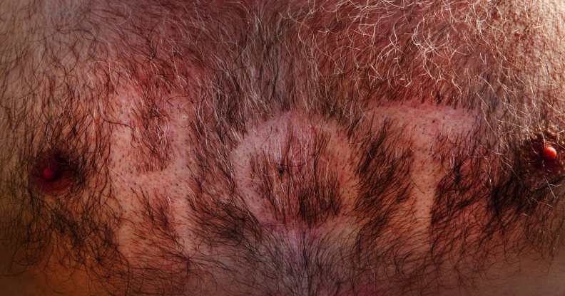 A hairy, male chest with the word HOT shaved into it, Glastonbury Festival 2010.