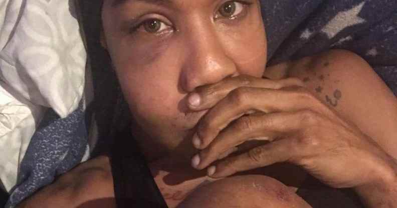 New York attack queer trans