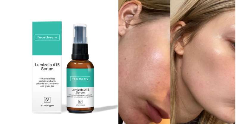 Facetheory's Lumizela Azelaic Acid Serum has been getting rave reviews.