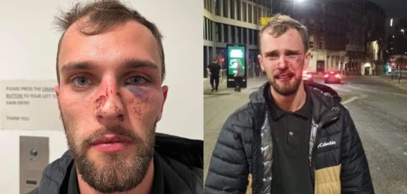 Side-by-side photographs of a young white man covered in blood and bruises