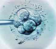 IVF Procedure