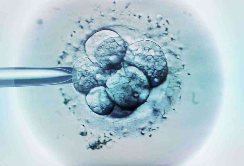 IVF Procedure