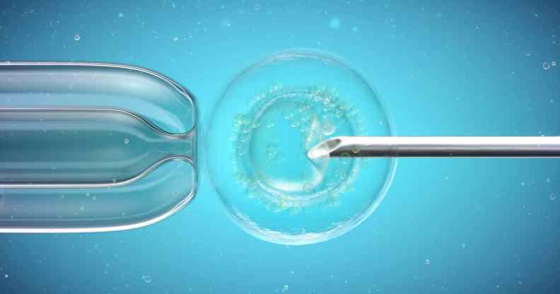 Sperm donor with incurable condition fathered 15 children to lesbian mothers