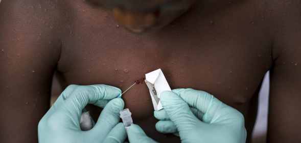 A teenager with suspected monkeypox