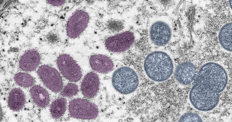 Digitally-colorized electron microscopic (EM) image depicting a monkeypox virion (virus particle)