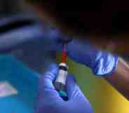 A medical professional prepares a dose of the monkeypox vaccine on July 23, 2022 in London, England.