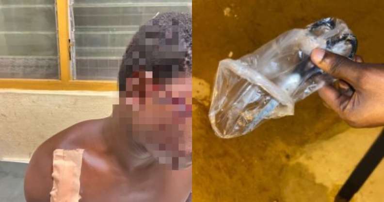 On the left: A man with his face blurred who has suffered a cut to his head. On the right: A pair of scissors wrapped up in a plastic bag