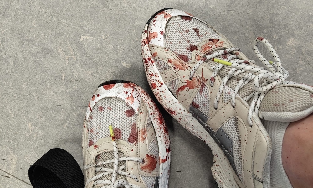 In this photograph, a pair of white trainers can be seen splattered with blood