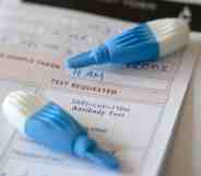 Lancets to prick the tip of the finger are pictured, part of an antibody test kit.