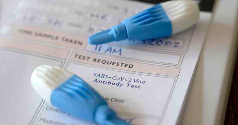 Lancets to prick the tip of the finger are pictured, part of an antibody test kit.