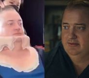 Brendan Fraser (left) being put into a prosthetic 'fat suit', and in a still from The Whale (right)