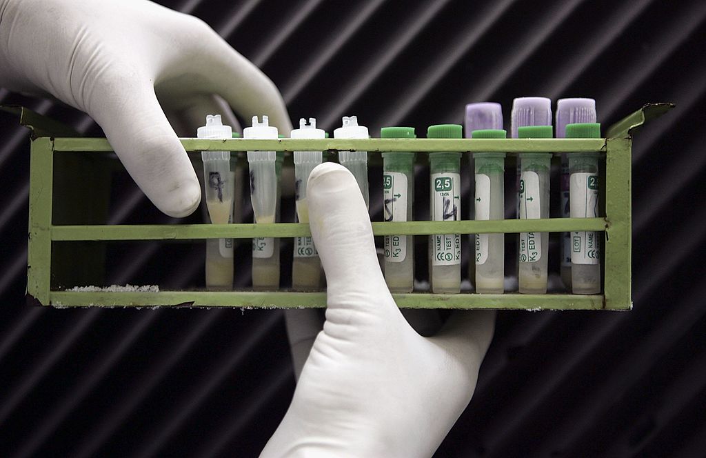 A medical technician handles HIV positive samples during testing at the Pakistan Institute of Medical Science. 