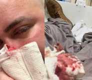 Victim of homophobic attack, Adrian Lea