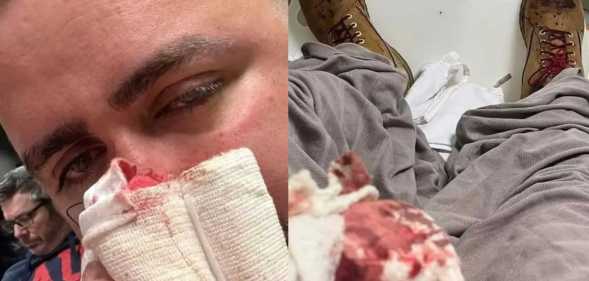 Victim of homophobic attack, Adrian Lea