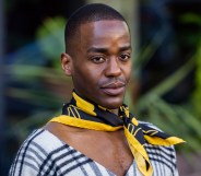 Ncuti Gatwa wearing a yellow and black necktie scarf and a white and black v-neck tartan top.