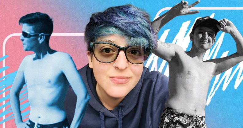 A graphic composed of images of trans and non-binary people who have had top surgery